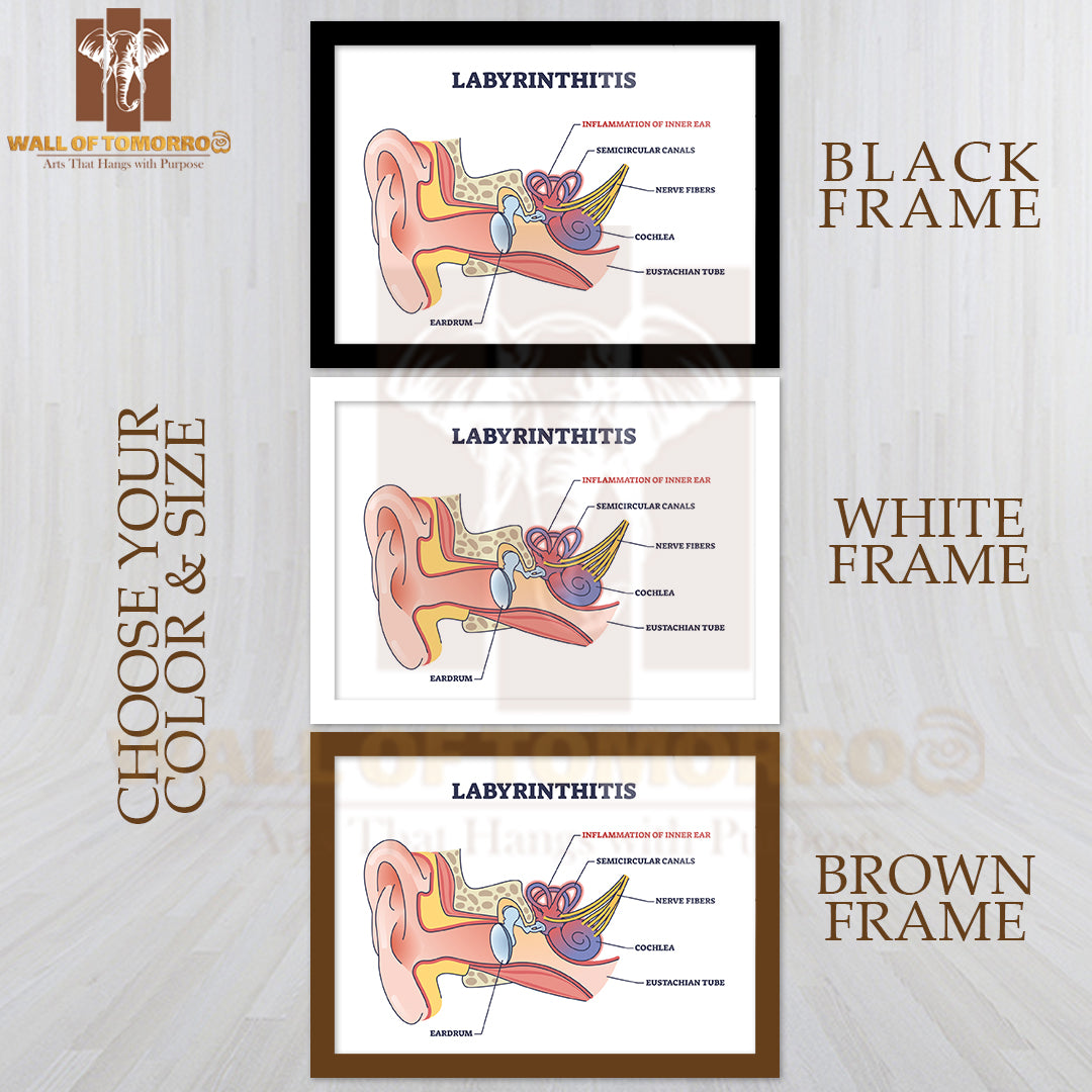Labyrinthitis As Inner Ear Infection and Medical Inflammation Outline Diagram Educational High Quality Glass Frame Wall Décor