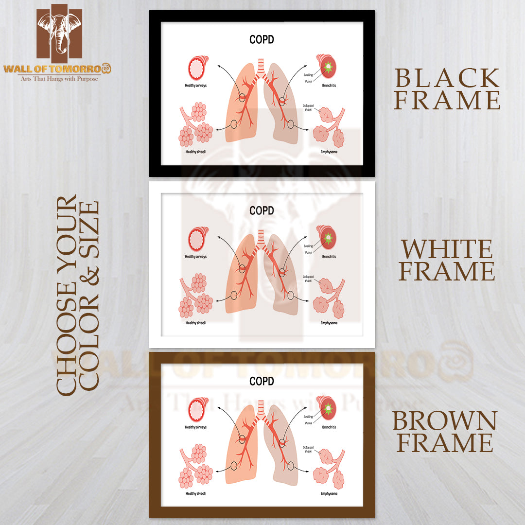 Chronic Obstructive Pulmonary Disease or COPD Educational High Quality Glass Frame Wall Décor