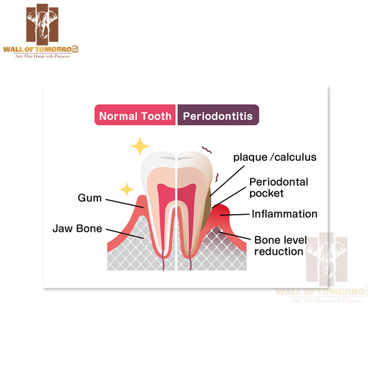 Comparison Of Normal Teeth and Periodontal Disease Educational High Quality Unframed Poster Print & Waterproof Poster Print Wall Décor