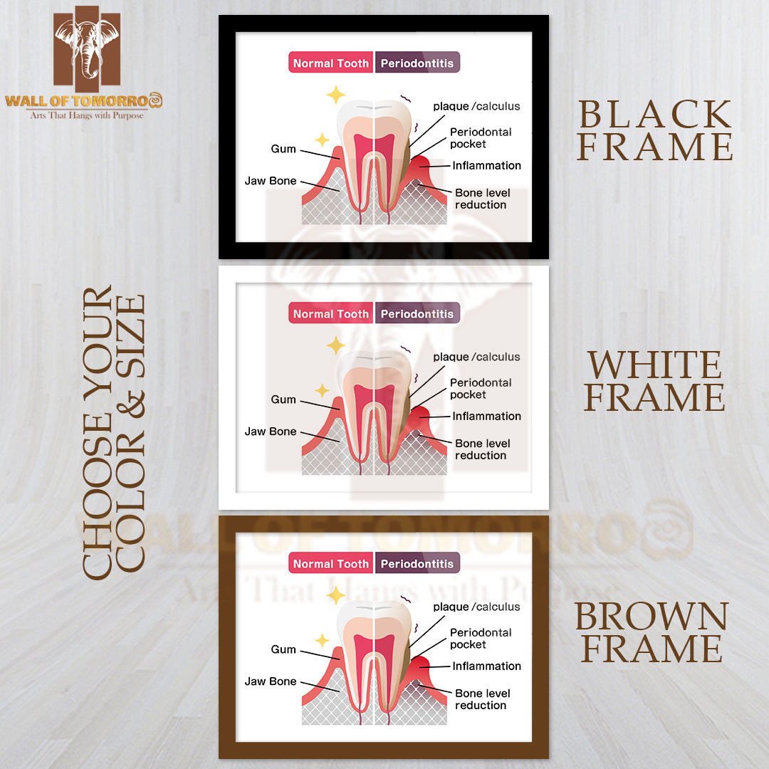 Comparison Of Normal Teeth and Periodontal Disease Educational High Quality Glass Frame Wall Décor