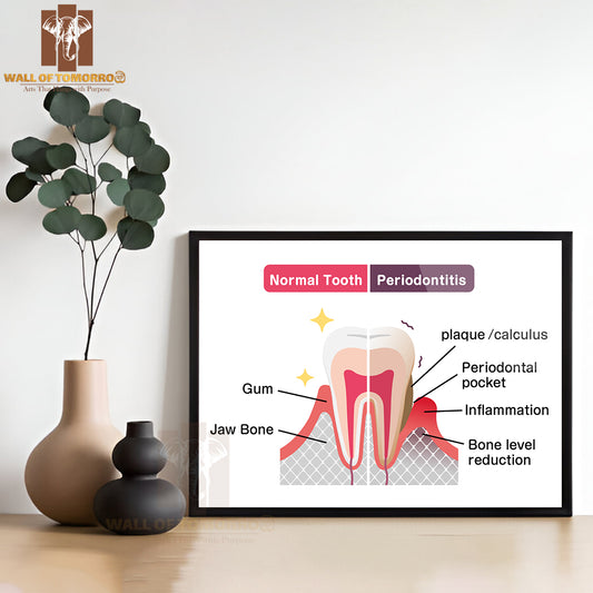 Comparison Of Normal Teeth and Periodontal Disease Educational High Quality Glass Frame Wall Décor