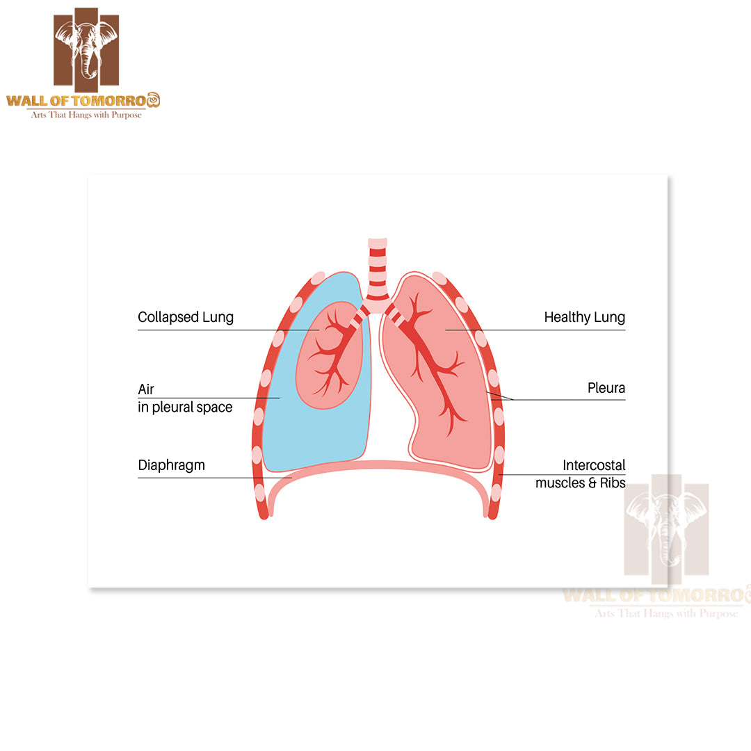 Chest Pain, Shortness of Breathing. Unhealthy Internal Organs in Respiratory System Educational High Quality Unframed Poster Print & Waterproof Poster Print Wall Décor