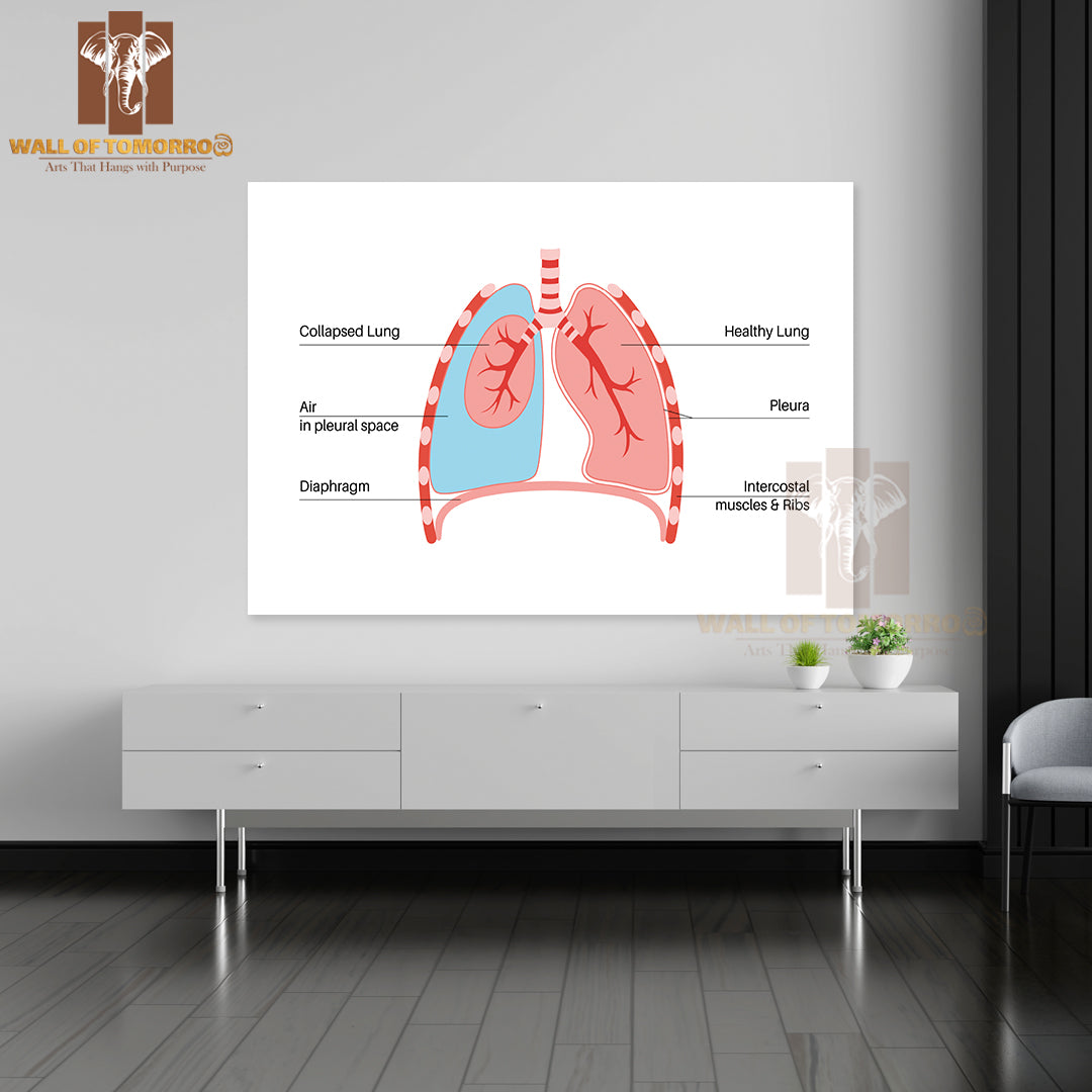 Chest Pain, Shortness of Breathing. Unhealthy Internal Organs in Respiratory System Educational High Quality Unframed Poster Print & Waterproof Poster Print Wall Décor