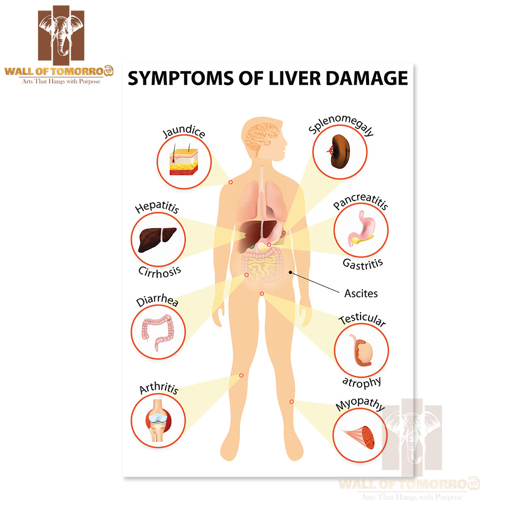 Symptoms Of Liver Damage, Human Silhouette with Internal Organs Educational High Quality Unframed Poster Print & Waterproof Poster Print Wall Décor