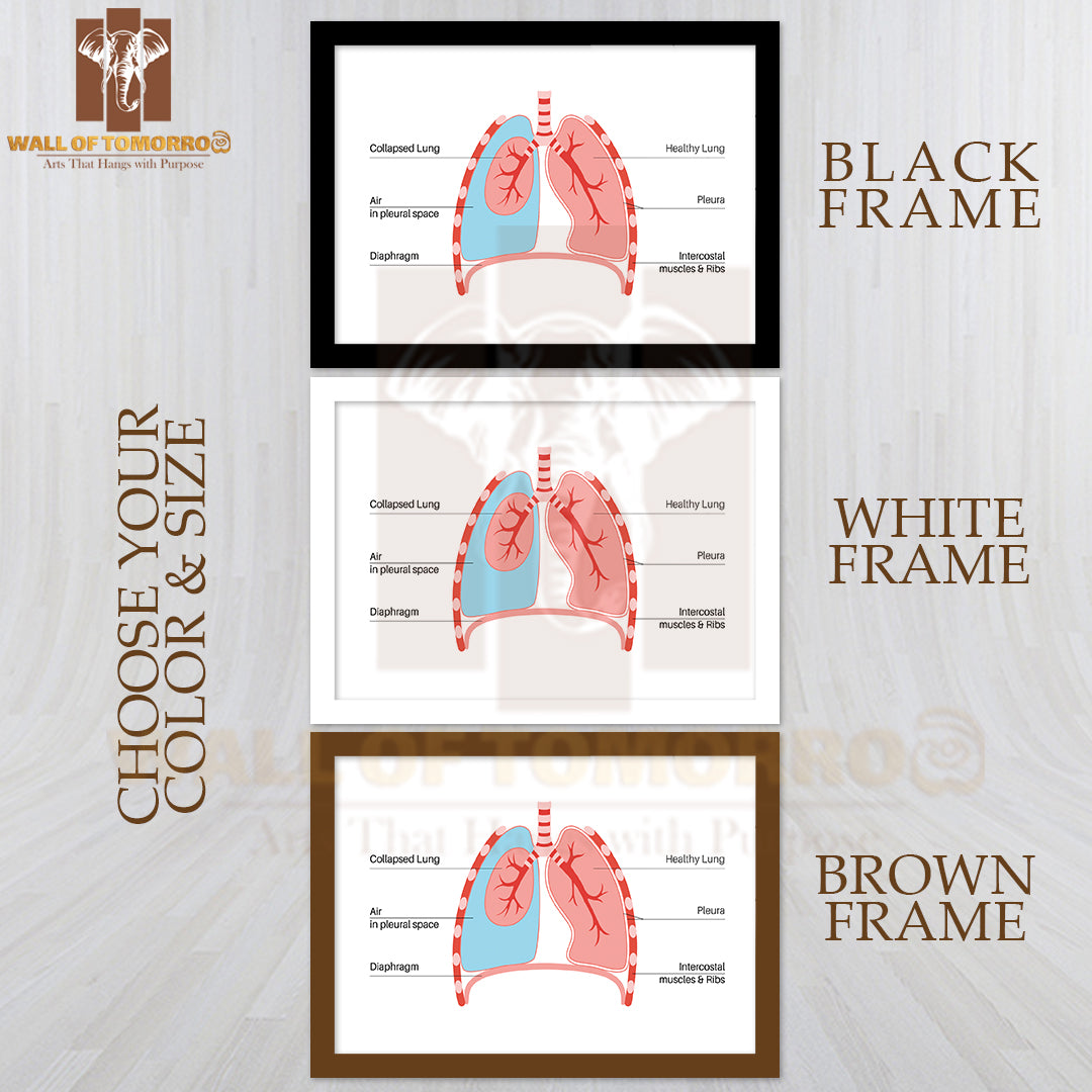 Chest Pain, Shortness of Breathing. Unhealthy Internal Organs in Respiratory System Educational High Quality Glass Frame Wall Décor