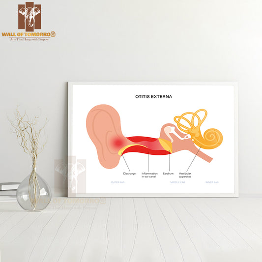 Otitis Externa, Swimmers Ear Disease. Pain And Inflammation, Earache in The Human Head Educational High Quality Glass Frame Wall Décor