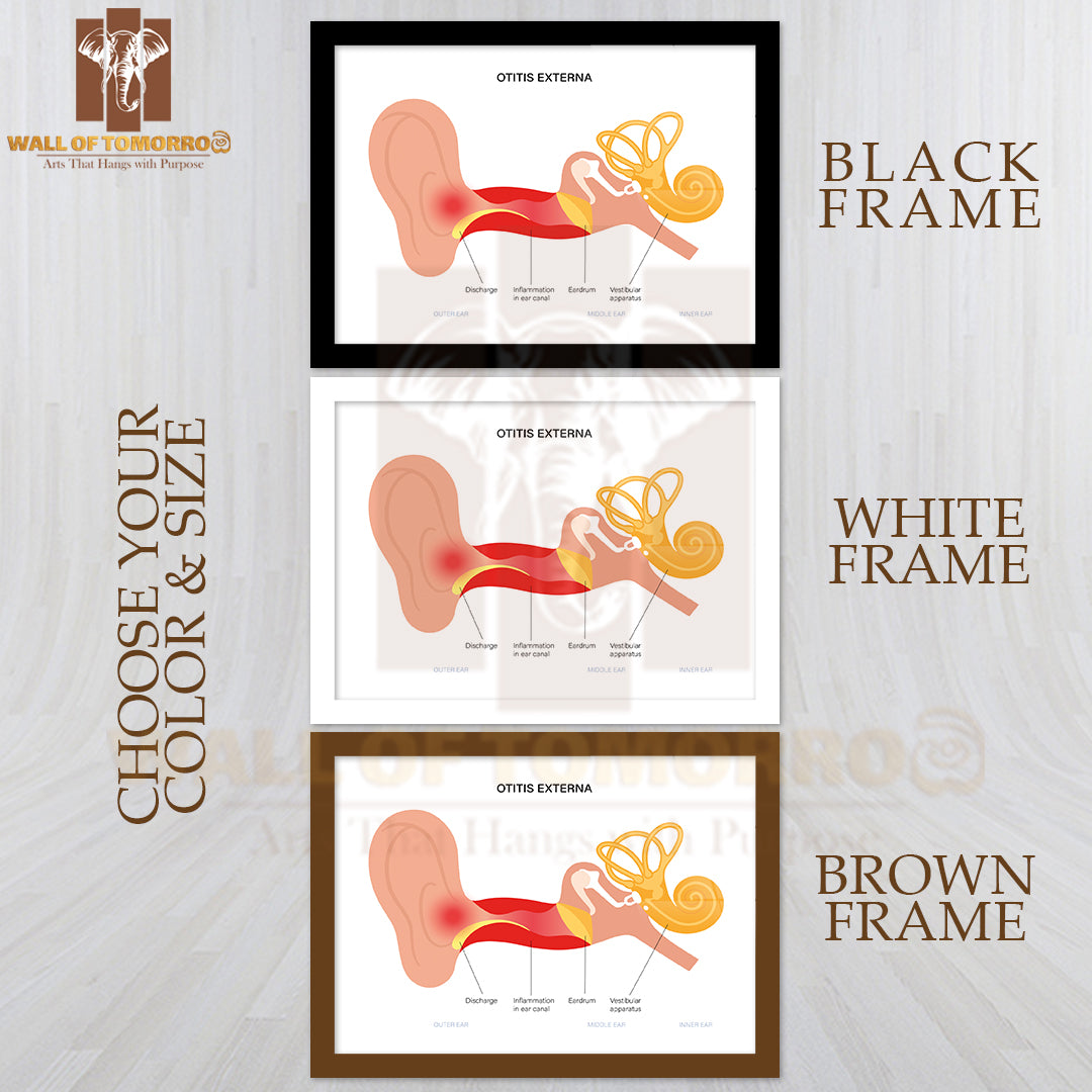 Otitis Externa, Swimmers Ear Disease. Pain And Inflammation, Earache in The Human Head Educational High Quality Glass Frame Wall Décor