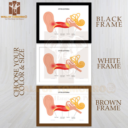 Otitis Externa, Swimmers Ear Disease. Pain And Inflammation, Earache in The Human Head Educational High Quality Glass Frame Wall Décor