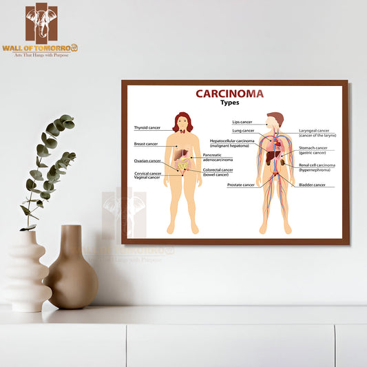 Carcinoma. Type Of Cancer. Woman And Man Silhouette with Highlighted Internal Organs Educational High Quality Glass Frame Wall Décor