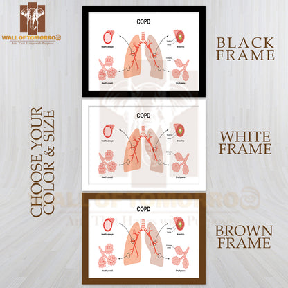 Chronic Obstructive Pulmonary Disease or COPD Educational High Quality Glass Frame Wall Décor