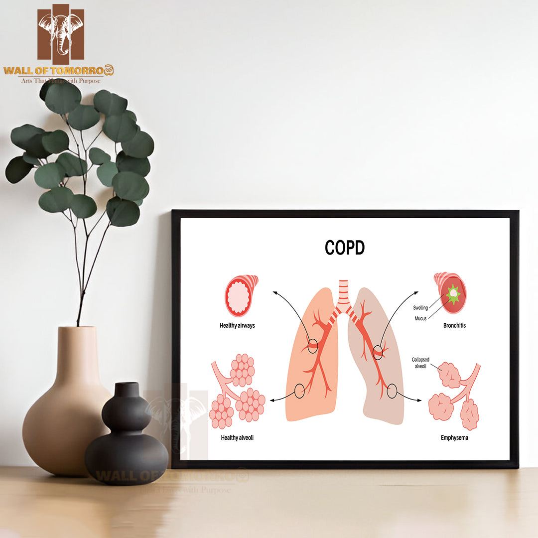 Chronic Obstructive Pulmonary Disease or COPD Educational High Quality Glass Frame Wall Décor