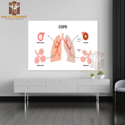 Chronic Obstructive Pulmonary Disease or COPD Educational High Quality Unframed Poster Print & Waterproof Poster Print Wall Décor