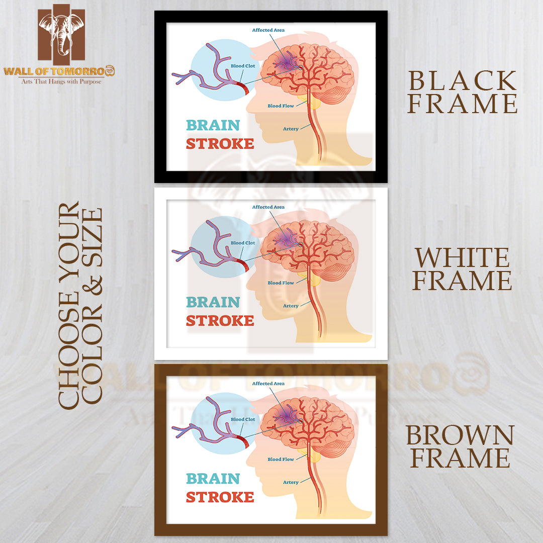 Diagram, Scheme with Brains Blood Flow and Blood Clot Educational High Quality Glass Frame Wall Décor