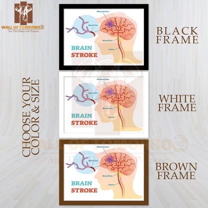 Diagram, Scheme with Brains Blood Flow and Blood Clot Educational High Quality Glass Frame Wall Décor