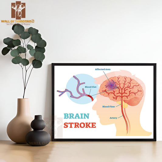 Diagram, Scheme with Brains Blood Flow and Blood Clot Educational High Quality Glass Frame Wall Décor